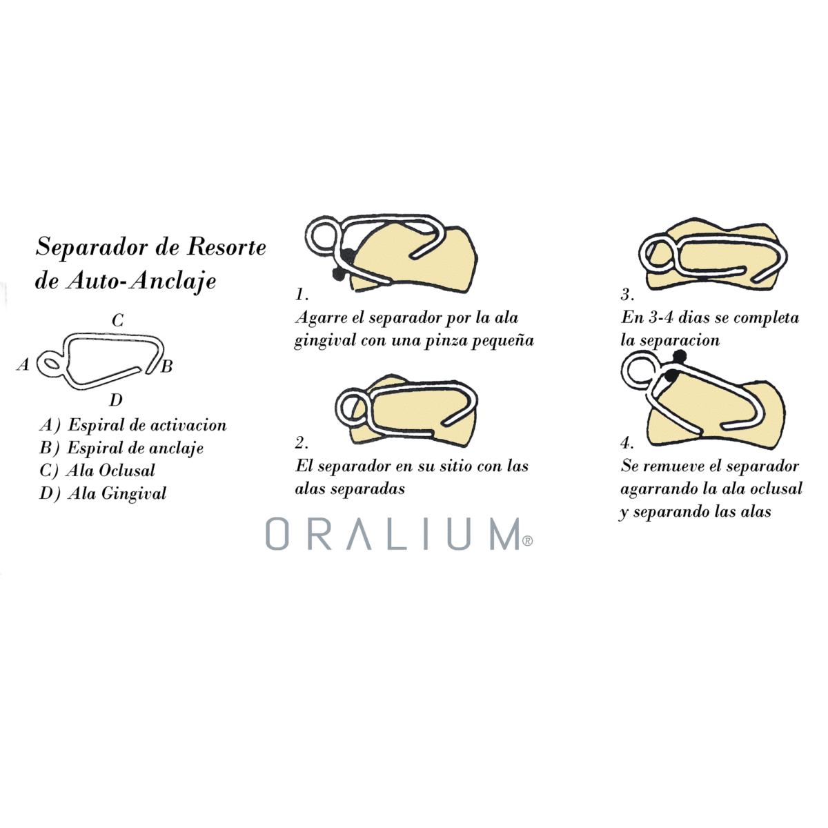 Separadores de Resorte de Auto-Anclaje - Image 4