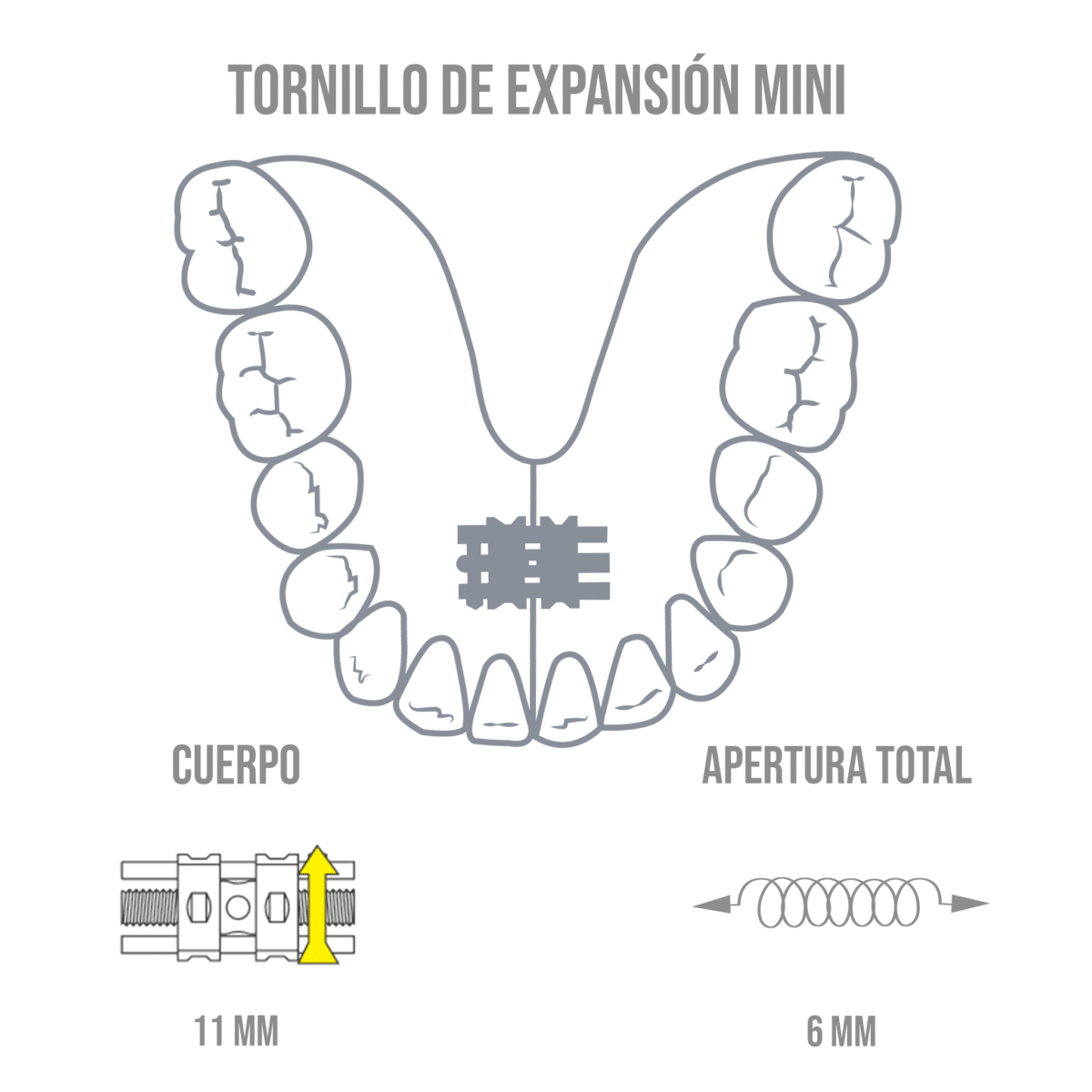 Tornillo De Expansión Mini -Marca: Leone Tornillos | Odontology BG