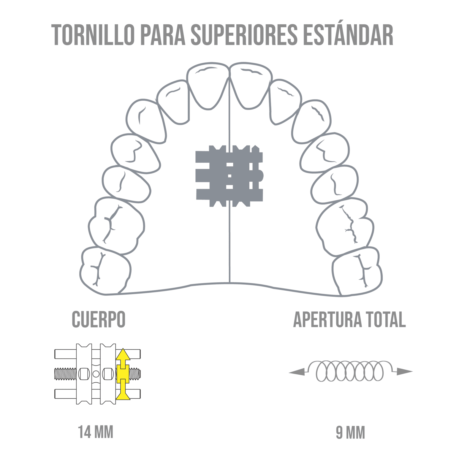 Tornillo De Expansión Superior Deposito Dental Odontology BG