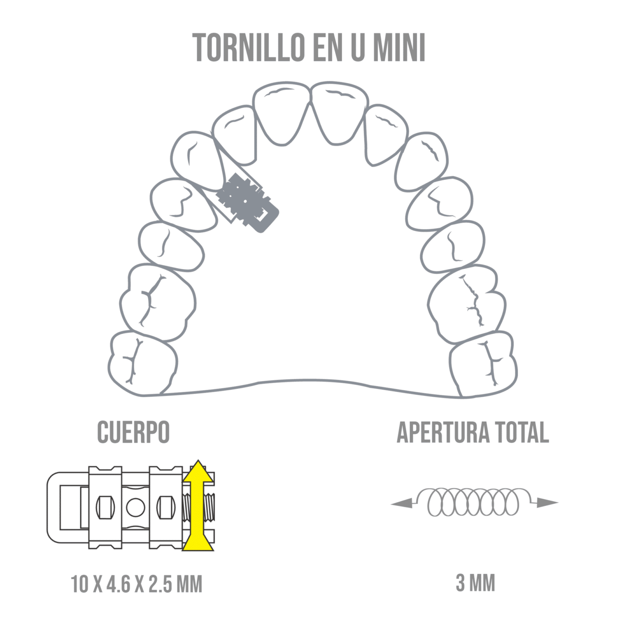 Tornillo En U Mini -Marca: Leone Tornillos | Odontology BG