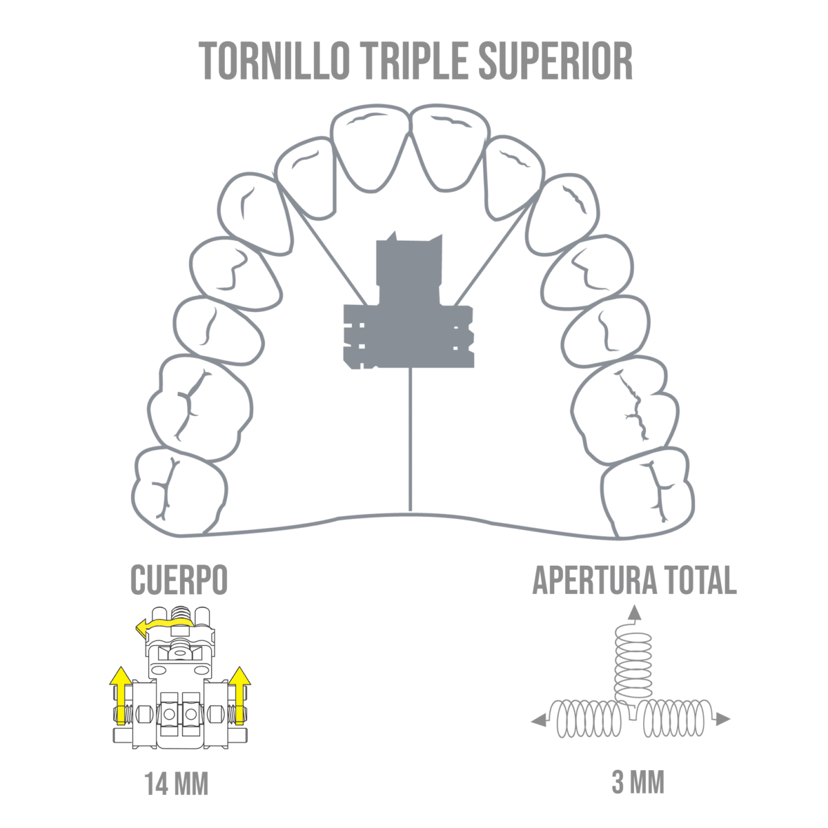 Tornillo Triple Superior -Marca: Leone Tornillos | Odontology BG