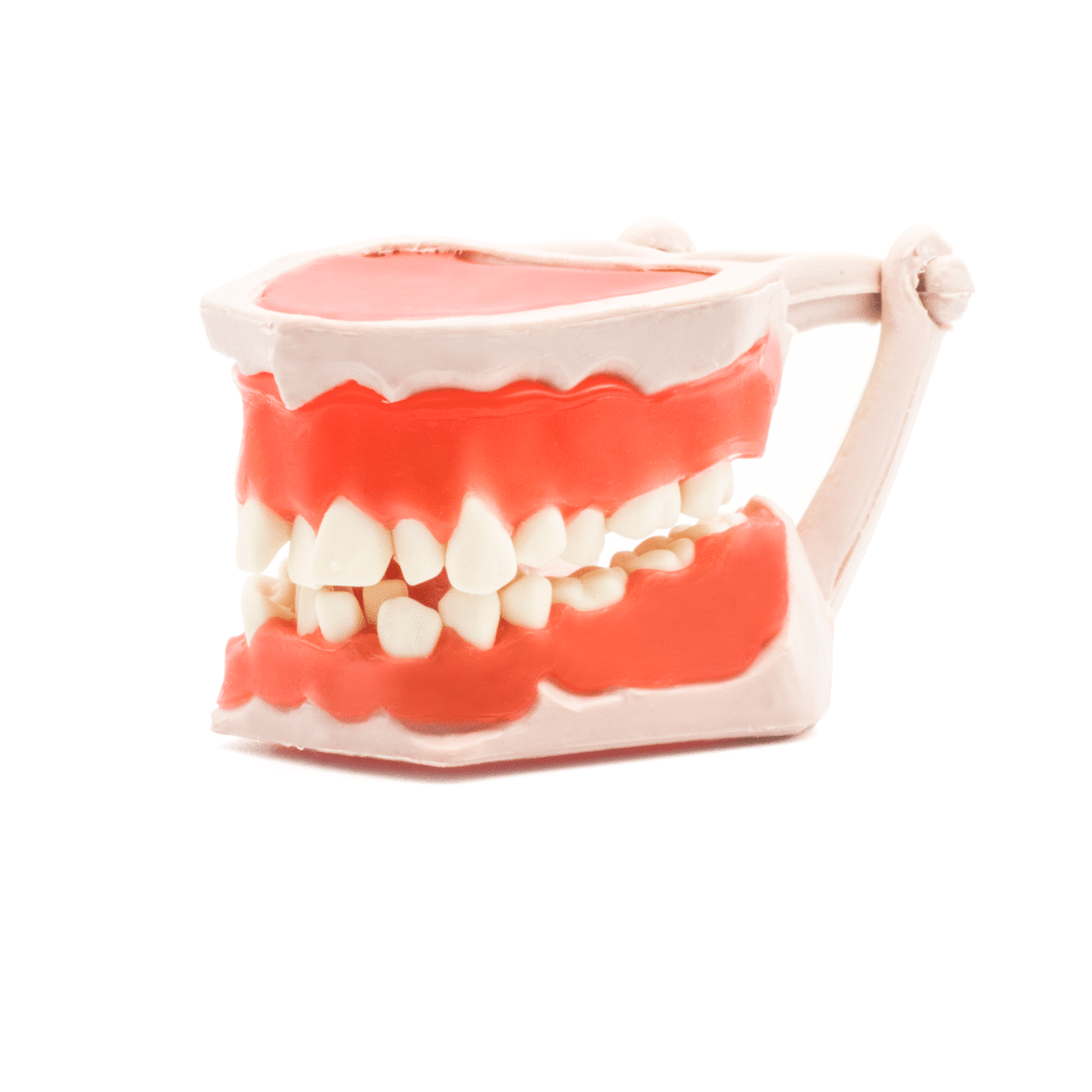 Tipodonto -Marca: Tirden Articuladores | Odontology BG